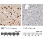 Merck Anti-CCSAP antibody produced in rabbit