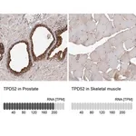 Merck Anti-TPD52 antibody produced in rabbit