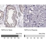 Merck Anti-TSPYL5 antibody produced in rabbit
