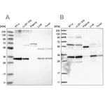 Merck Anti-PPCS antibody produced in rabbit