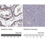 Merck Anti-SCNN1D antibody produced in rabbit