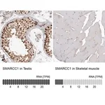 Merck Anti-SMARCC1 antibody produced in rabbit