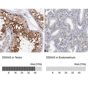 Merck Anti-DDX43 antibody produced in rabbit
