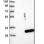 Merck Anti-DIRAS3 antibody produced in rabbit