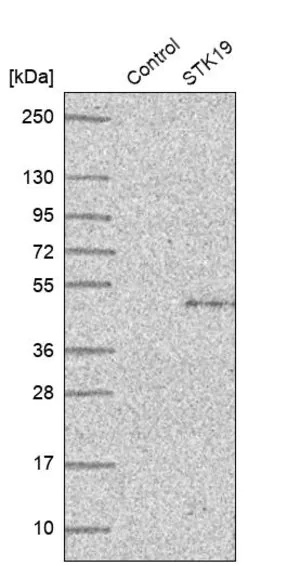 Merck Anti-STK19 antibody produced in rabbit