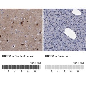 Merck Anti-KCTD8 antibody produced in rabbit