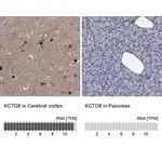 Merck Anti-KCTD8 antibody produced in rabbit