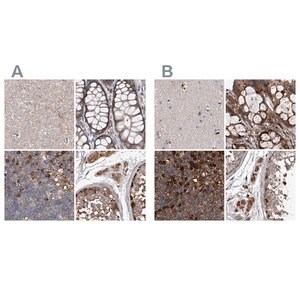 Merck Anti-ASCC3 antibody produced in rabbit