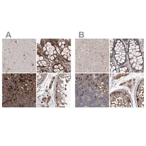Merck Anti-ASCC3 antibody produced in rabbit