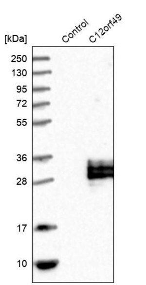 Merck Anti-C12orf49 antibody produced in rabbit