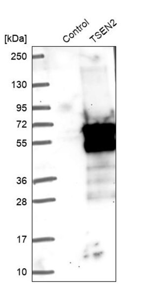 Merck Anti-TSEN2 antibody produced in rabbit