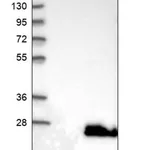 Merck Anti-BAALC antibody produced in rabbit