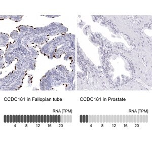 Merck Anti-CCDC181 antibody produced in rabbit