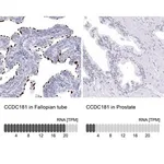 Merck Anti-CCDC181 antibody produced in rabbit