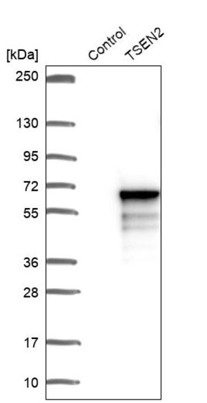 Merck Anti-TSEN2 antibody produced in rabbit