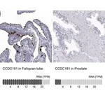 Merck Anti-CCDC181 antibody produced in rabbit