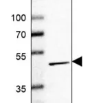 Merck Anti-ACP6 antibody produced in rabbit