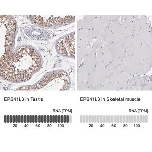 Merck Anti-EPB41L3 antibody produced in rabbit
