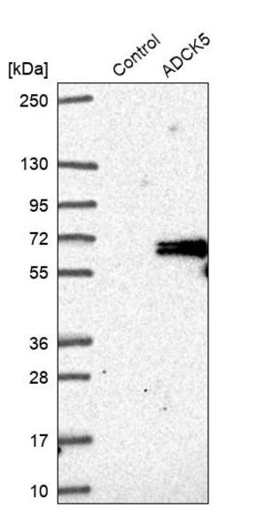 Merck Anti-ADCK5 antibody produced in rabbit