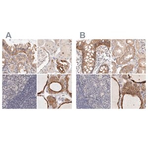 Merck Anti-ANXA9 antibody produced in rabbit