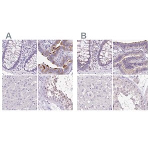 Merck Anti-ANKRD45 antibody produced in rabbit