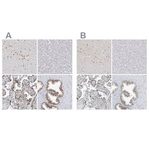 Merck Anti-WRNIP1 antibody produced in rabbit