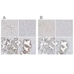 Merck Anti-WRNIP1 antibody produced in rabbit