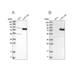 Merck Anti-COLGALT2 antibody produced in rabbit