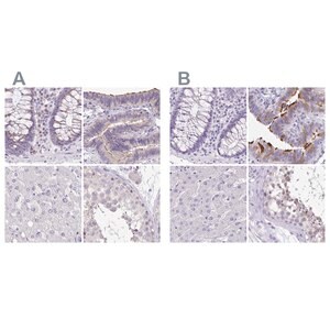 Merck Anti-ANKRD45 antibody produced in rabbit
