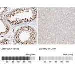 Merck Anti-ZMYM2 antibody produced in rabbit