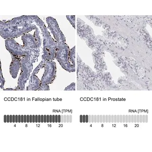 Merck Anti-CCDC181 antibody produced in rabbit