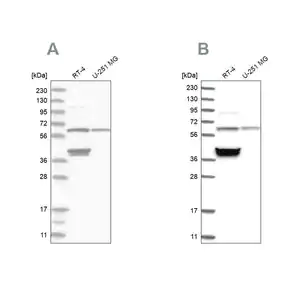 Merck Anti-TCP1 antibody produced in rabbit