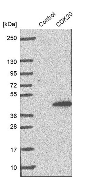 Merck Anti-CDK20 antibody produced in rabbit