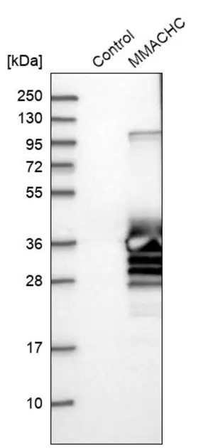 Merck Anti-MMACHC antibody produced in rabbit