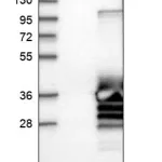 Merck Anti-MMACHC antibody produced in rabbit