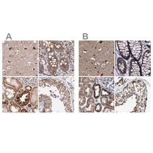 Merck Anti-MECR antibody produced in rabbit