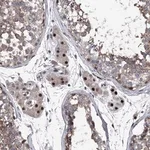 Merck Anti-ELK4 antibody produced in rabbit