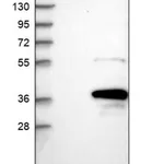 Merck Anti-MOGAT2 antibody produced in rabbit