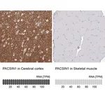 Merck Anti-PACSIN1 antibody produced in rabbit