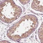 Merck Anti-TRIM69 antibody produced in rabbit