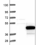 Merck Anti-KLHDC9 antibody produced in rabbit