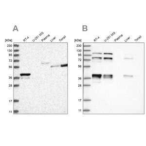 Merck Anti-PLEKHA3 antibody produced in rabbit