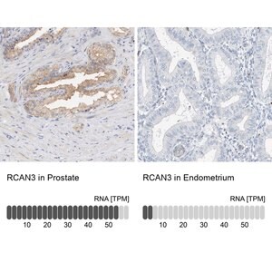 Merck Anti-RCAN3 antibody produced in rabbit