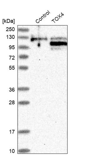 Merck Anti-TOX4 antibody produced in rabbit