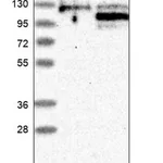 Merck Anti-TOX4 antibody produced in rabbit