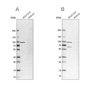 Merck Anti-PNPT1 antibody produced in rabbit