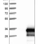 Merck Anti-RILPL2 antibody produced in rabbit