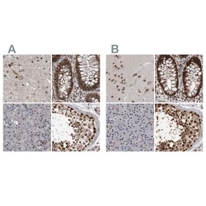 Merck Anti-CHD1L antibody produced in rabbit