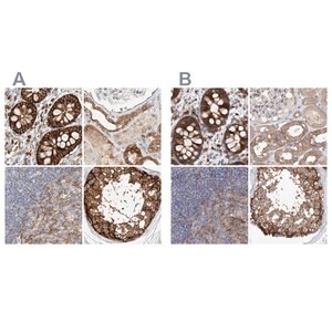 Merck Anti-CARMIL1 antibody produced in rabbit