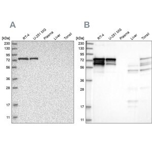 Merck Anti-PPP2R5D antibody produced in rabbit